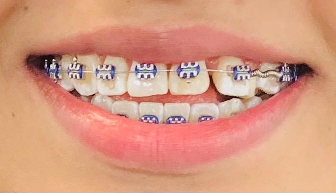 Logra la sonrisa de tus sueños